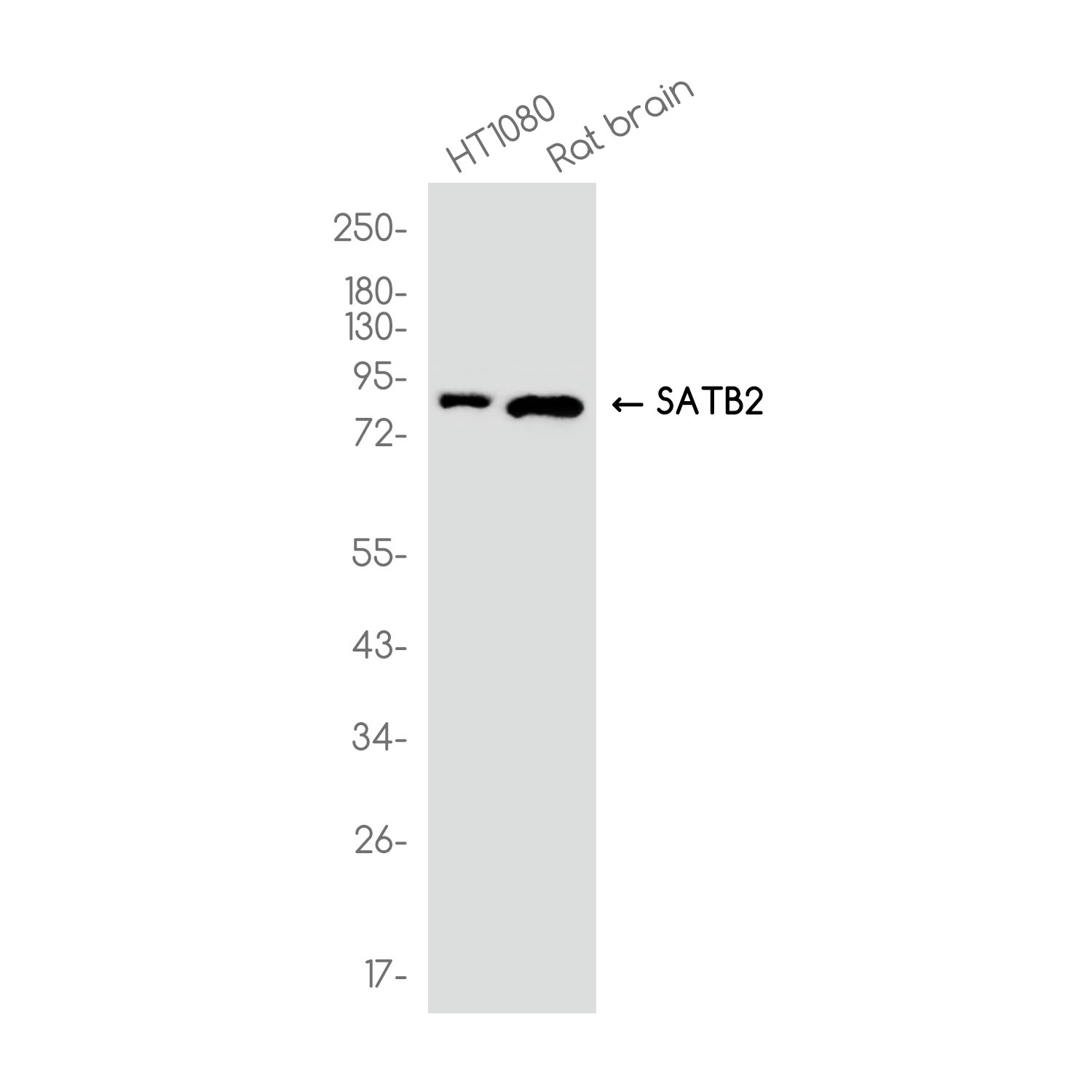 1 - SATB2 Rabbit mAb AP78946