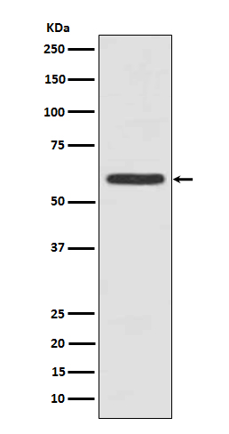 1 - Cytokeratin 5 Rabbit mAb AP77373