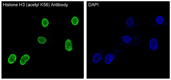 3 - Acetyl-Histone H3 (Lys56) Rabbit mAb AP77368