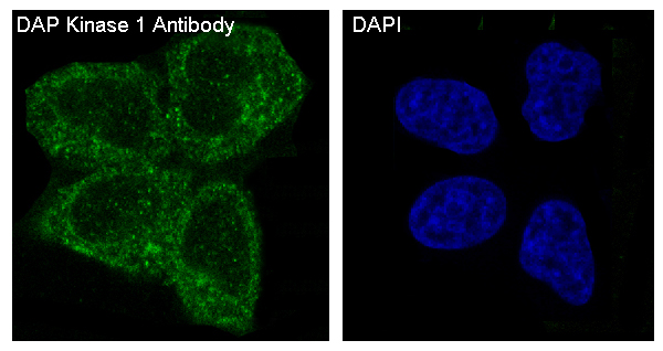 3 - DAP Kinase 1 Rabbit mAb AP77357
