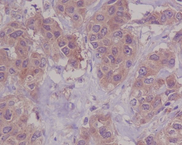 2 - DAP Kinase 1 Rabbit mAb AP77357