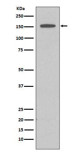 1 - DAP Kinase 1 Rabbit mAb AP77357