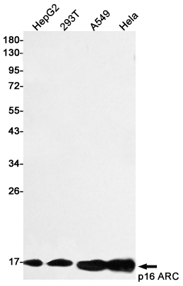 1 - p16 ARC Rabbit mAb AP77354
