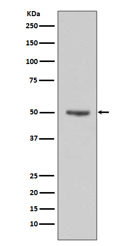 1 - Cyclin E1 Rabbit mAb AP77468