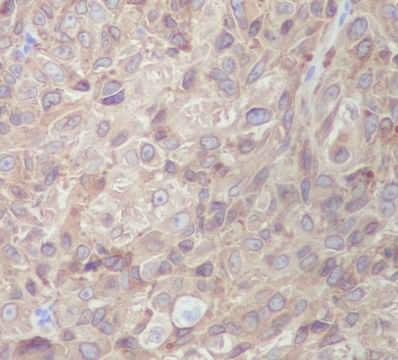 2 - MelanA Rabbit mAb AP77487