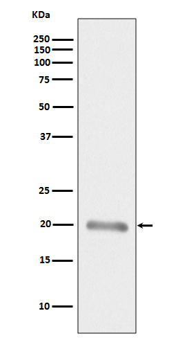 1 - MelanA Rabbit mAb AP77487
