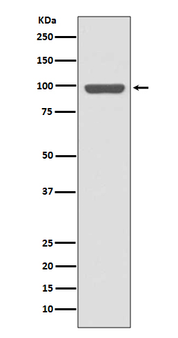 1 - Insulin Receptor Rabbit mAb AP76948