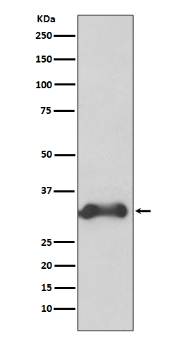 1 - Cyclin D3 Rabbit mAb AP77289