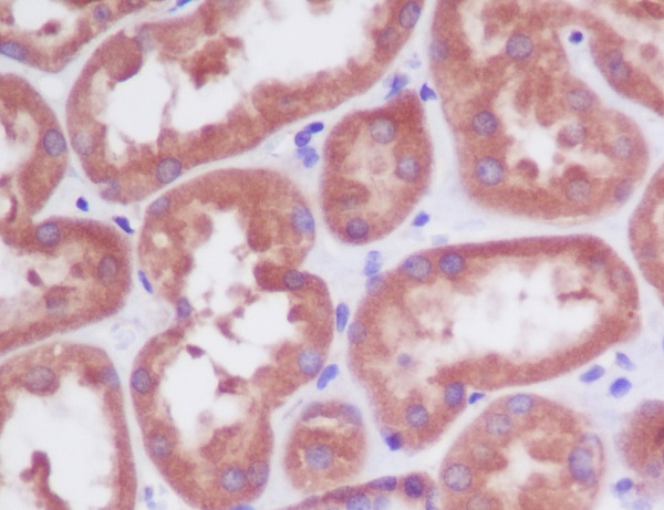 2 - PDPK1 Rabbit mAb AP77548