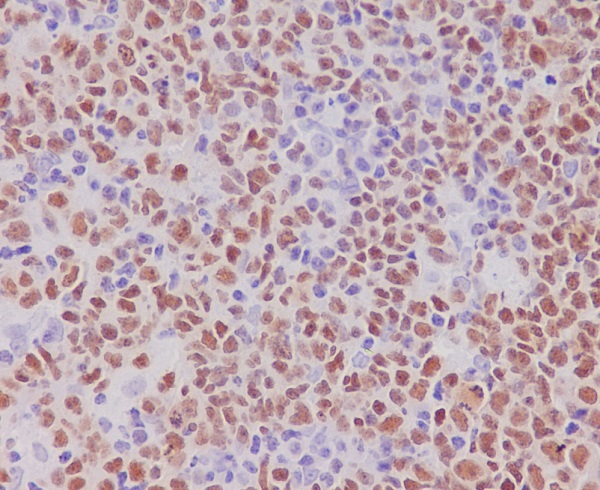 2 - PAX5 Rabbit mAb AP77263