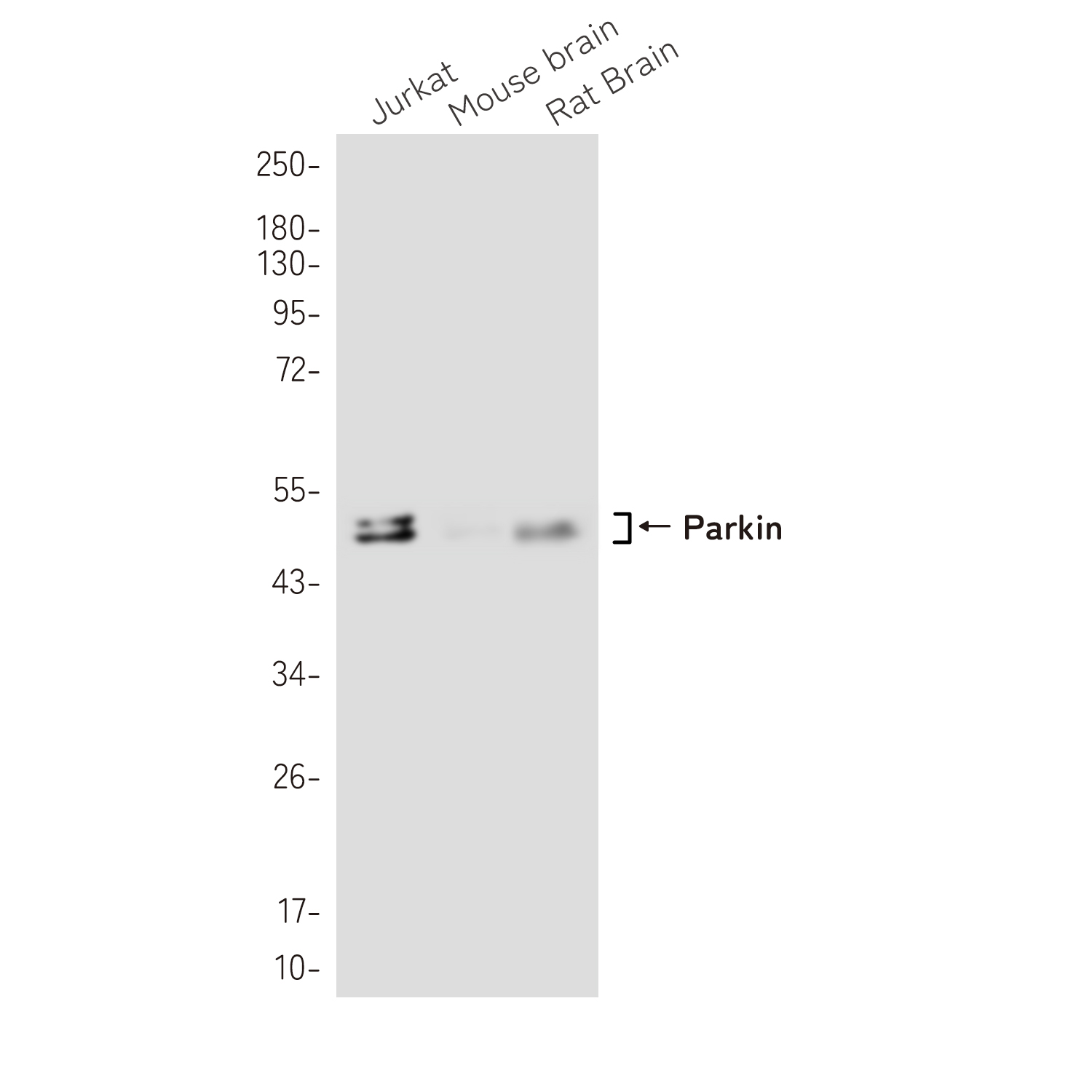 1 - Parkin Rabbit mAb AP78993