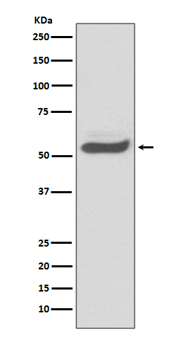 1 - alpha 1-Antitrypsin Rabbit mAb AP77611