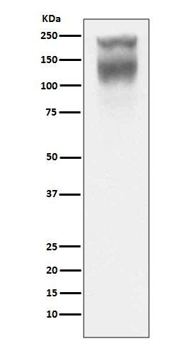 1 - Carcino Embryonic Antigen CEA (CD66e) Rabbit mAb AP77244