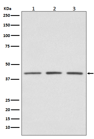 1 - PRMT1 Rabbit mAb AP77228