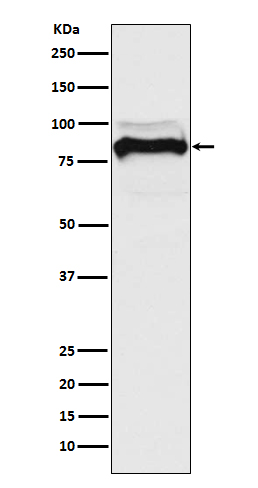 1 - TGF beta Receptor II Rabbit mAb AP77689