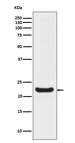 1 - RBP4 Rabbit mAb AP77737