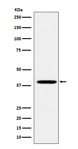 1 - Folate Binding Protein Rabbit mAb AP77742