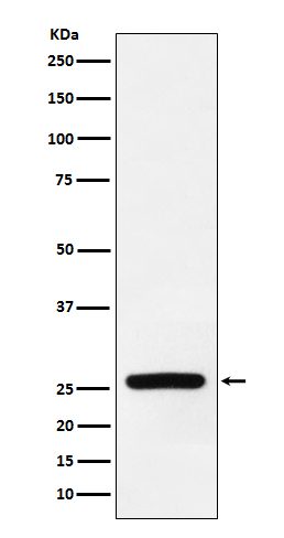 1 - Superoxide Dismutase 3 Rabbit mAb AP77179