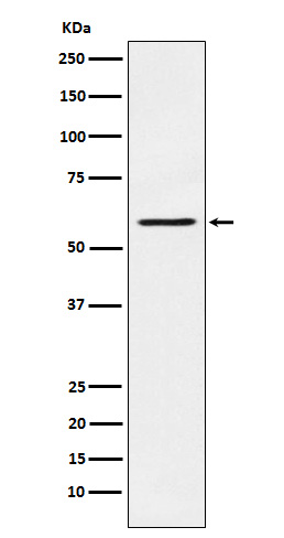 1 - PAK1 Rabbit mAb AP77796