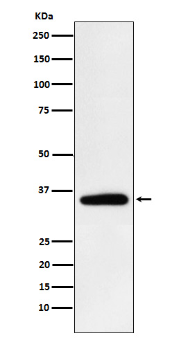 1 - Pyruvate Dehydrogenase E1 beta Rabbit mAb AP77159