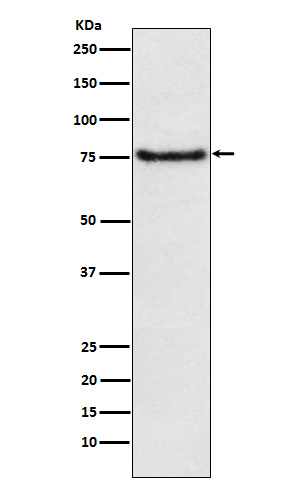 1 - BDKRB2 Rabbit mAb AP77833