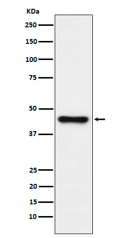 1 - ABHD5 Rabbit mAb AP77852