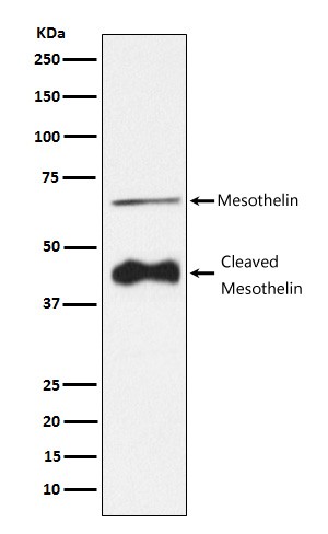 1 - Mesothelin Rabbit mAb AP77137