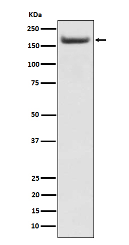 1 - IRS2 Rabbit mAb AP77123