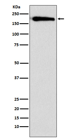 1 - SMARCC1 Rabbit mAb AP77962