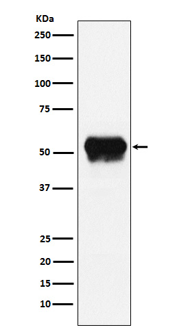 1 - Fibrinogen gamma Chain Rabbit mAb AP78021