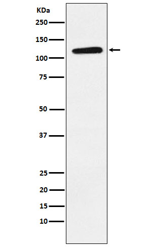 1 - Ephrin Receptor B1 Rabbit mAb AP77087