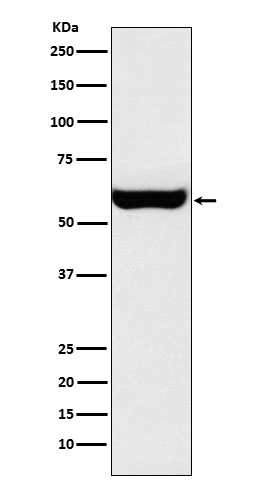 1 - Monoamine Oxidase A Rabbit mAb AP78079