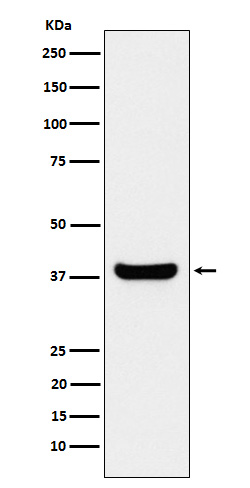 1 - PP1C beta Rabbit mAb AP78124