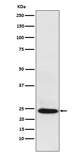 1 - BAG2 Rabbit mAb AP78143