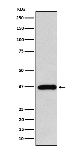1 - FBP1 Rabbit mAb AP78207