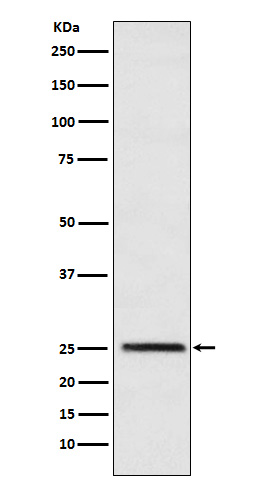 1 - Triosephosphate Isomerase Rabbit mAb AP77041