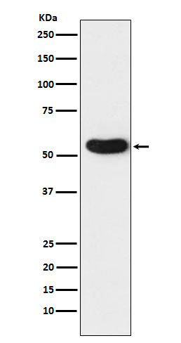 1 - Nicotinic Acetylcholine Receptor alpha 5 Rabbit mAb AP78338