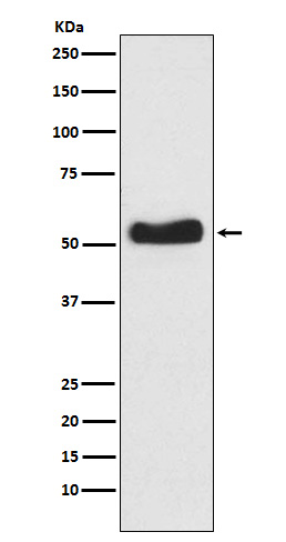1 - Glucokinase Rabbit mAb AP77033