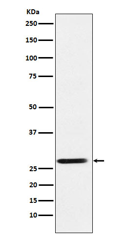1 - SRD5A2 Rabbit mAb AP78362
