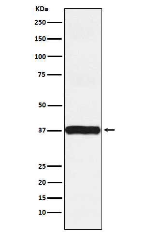 1 - Actin Related Protein 2 Rabbit mAb AP78403