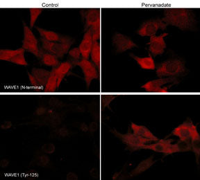 2 - Anti-WAVE1 (N-terminal region) Antibody AN2022