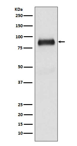 1 - SATB2 Antibody AP90164