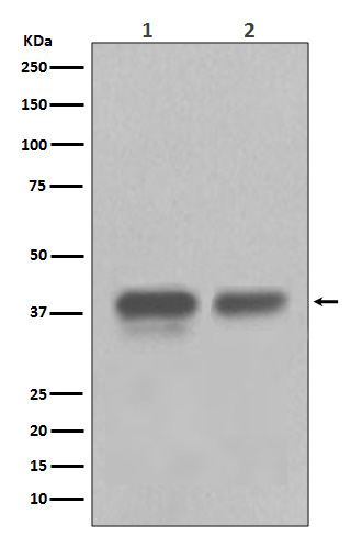 1 - CDX2 Antibody AP90176