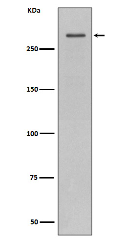 1 - ATM Antibody AP90255