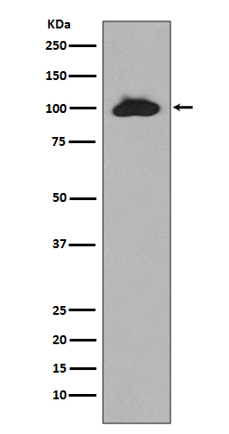1 - STAT6 Antibody AP90390