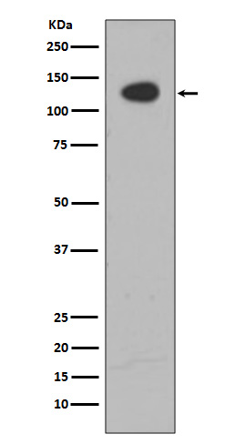 1 - ATP citrate lyase Antibody  AP90563