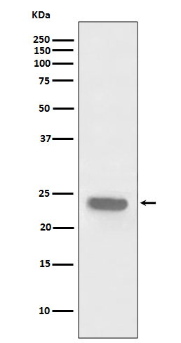 1 - PARK7 Antibody AP90747