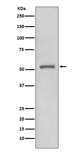 1 - MMP11 Antibody AP90779
