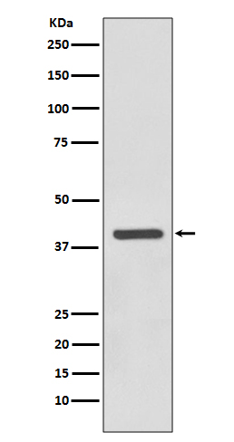 1 - SIRT6 Antibody AP90855