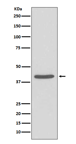 1 - SIRT2 Antibody AP90865